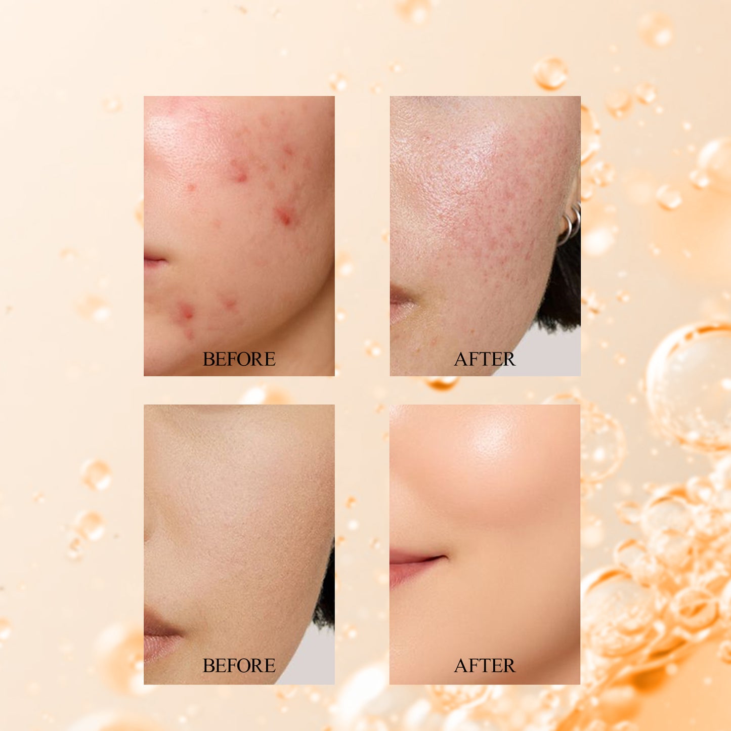 Vitamin C 10% + Niacinamide 2% | Radiance Serum | Brightens & Protects For all Skin Type | 30ml