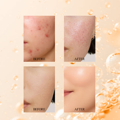 Vitamin C 10% + Niacinamide 2% | Radiance Serum